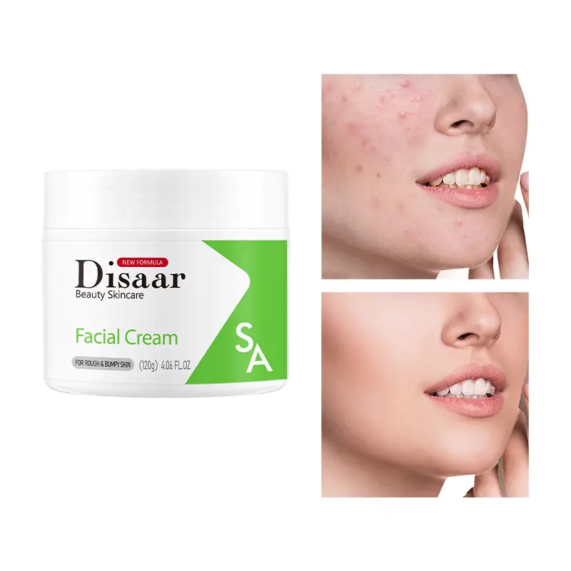 Crema Facial Disaar Anti-Acne 120 g — imagen 4